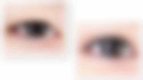 五、清远媄媄整形医院怎么预约：