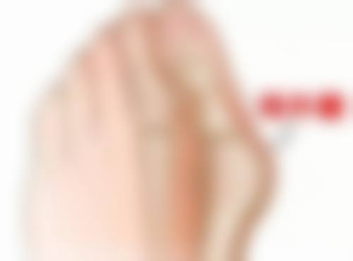 眼袋手术究竟要多久？外切口祛眼袋修复周期大揭秘