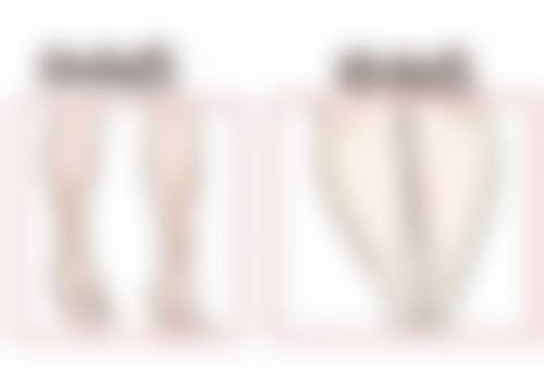 眼袋手术究竟多少天能恢复？不同术式恢复周期揭秘，助你快速变美 