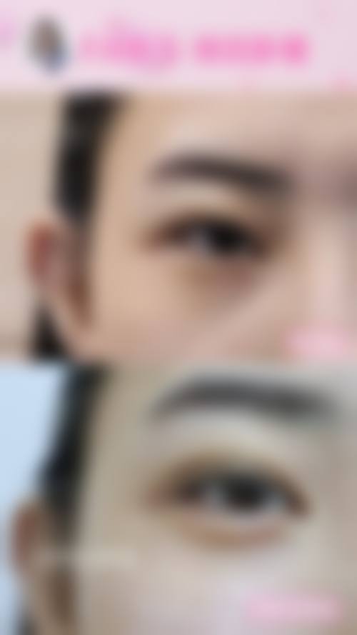 五、济南雅思医疗美容整形门诊部实例