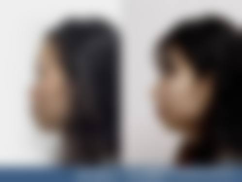 七、苏州万人迷医疗美容门诊部真实的顾客评价如下：