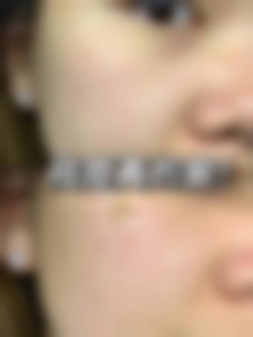 李艳艳医生口碑和评价