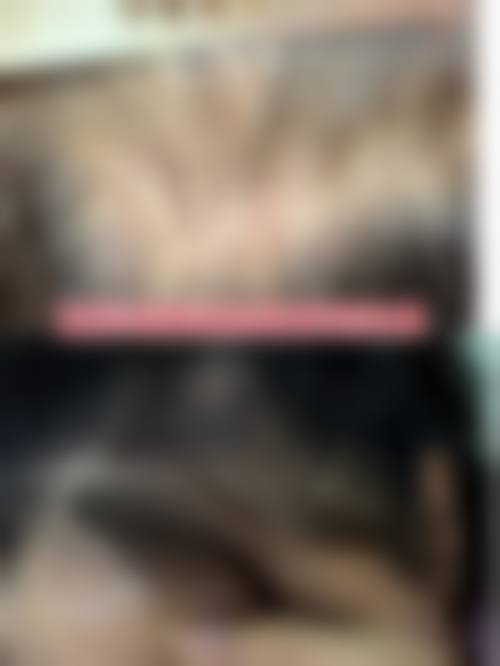 五、漳州解放军第175医院烧伤整形科实例