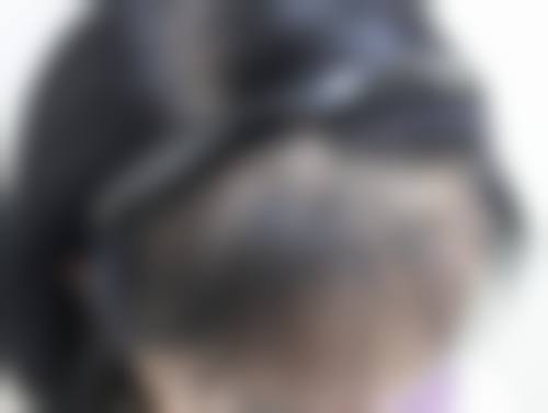 七、漳州解放军第175医院烧伤整形科价格表：（仅供参考）