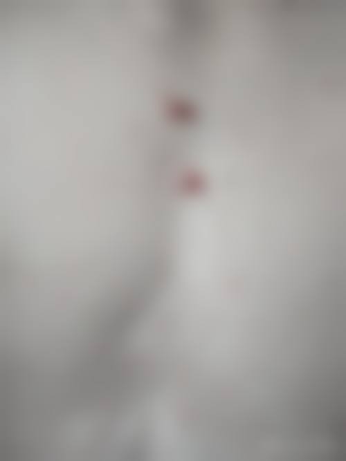 四、深圳恒美奢颜立整形医院开展的主要项目和特色项目：