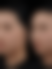 四、鞍山佳梦整形医院实例