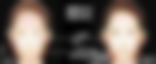 隆鼻取耳软骨到底好不好？对比肋软骨，凸显独特优势