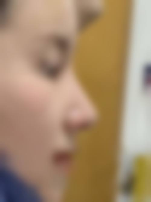 四、成都悦丽汇整形医疗美容门诊实例