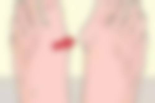 三点定位双眼皮会伤害眼睛吗？看看它的修复特点