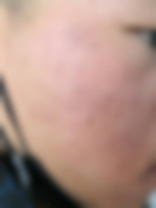 七、南宁首大医院医疗美容科价格表：（仅供参考）