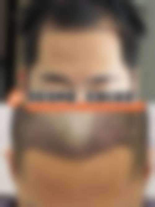 三、南昌碧莲盛植发医院基本信息：