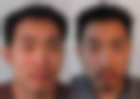 二、苏州百年植发正规吗？来看看医院资质：