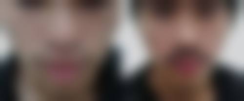 五、南昌碧莲盛植发医院怎么预约：