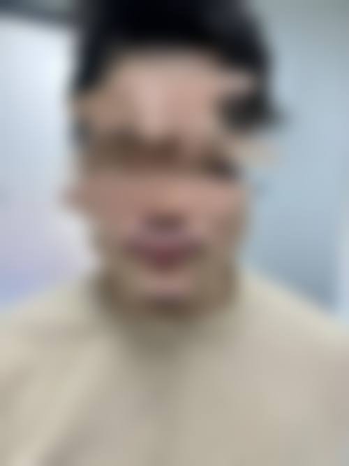 五、苏州百年植发实例