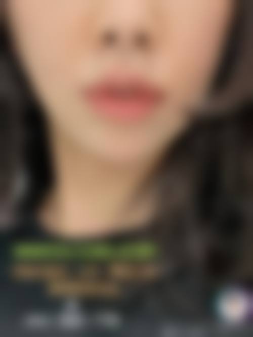 三、中山壹莱美整形医院基本信息：