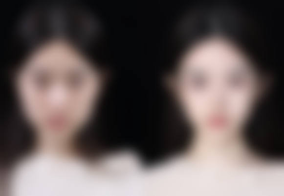 七、韩国dressps整形外科价格表：（仅供参考）