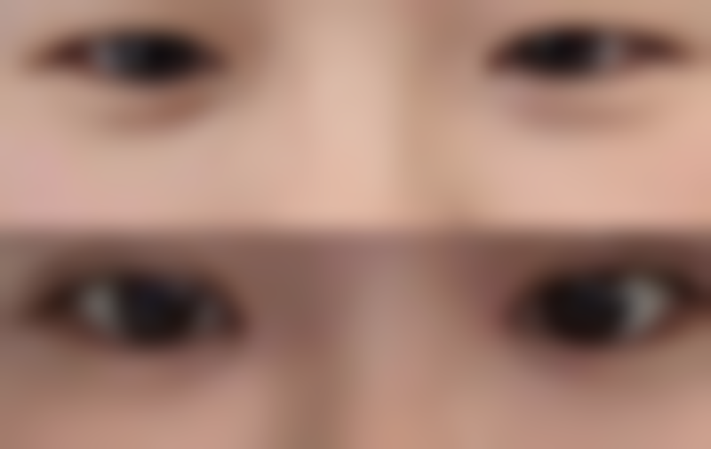 五、景德镇丽格整形医院怎么预约：