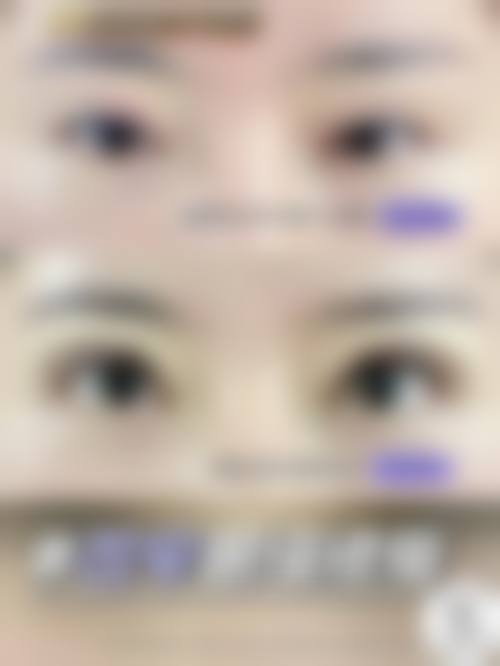 八、韩国拉菲安整形外科医院真实的顾客评价如下：