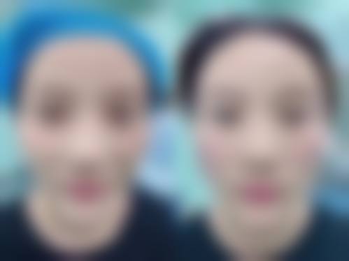 五、成都青羊欧文千亿整形医院怎么预约：