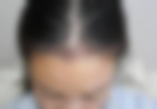 六、合肥国仁皮肤病医院医疗美容科怎么预约：