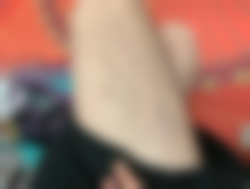 五、合肥国仁皮肤病医院医疗美容科实例