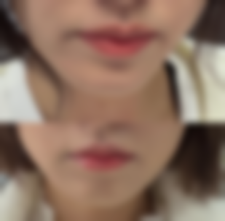 七、成都青羊欧文千亿整形医院真实的顾客评价如下：