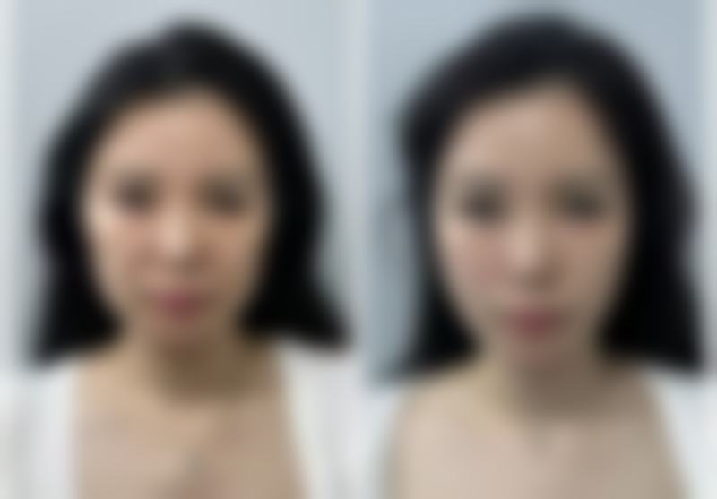 做好日常眼部护理，紧致眼周肌肤