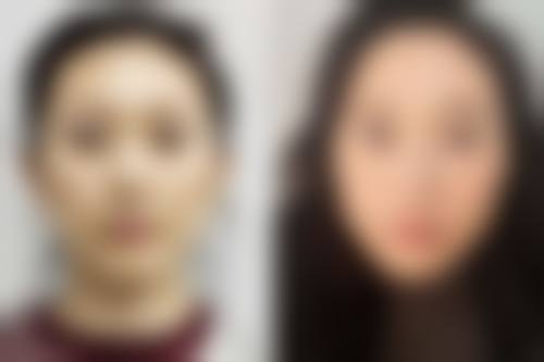 八、石家庄星面孔美兔整形医院真实的顾客评价如下：