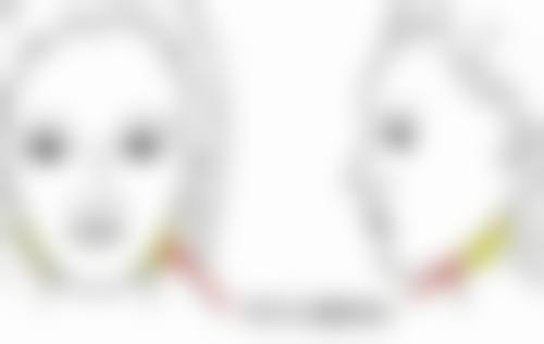 埋线双眼皮以后能取线吗？额外注意事项