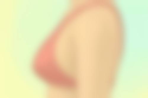 打保妥适瘦脸针后咋护理？记住术后注意事项