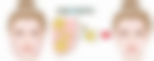 埋线双眼皮以后能取线吗？取线后后续手术建议