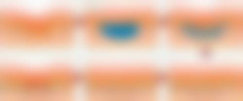 上海德琳医疗美容医院（男性私密中 心）乐威手术患者反馈理想