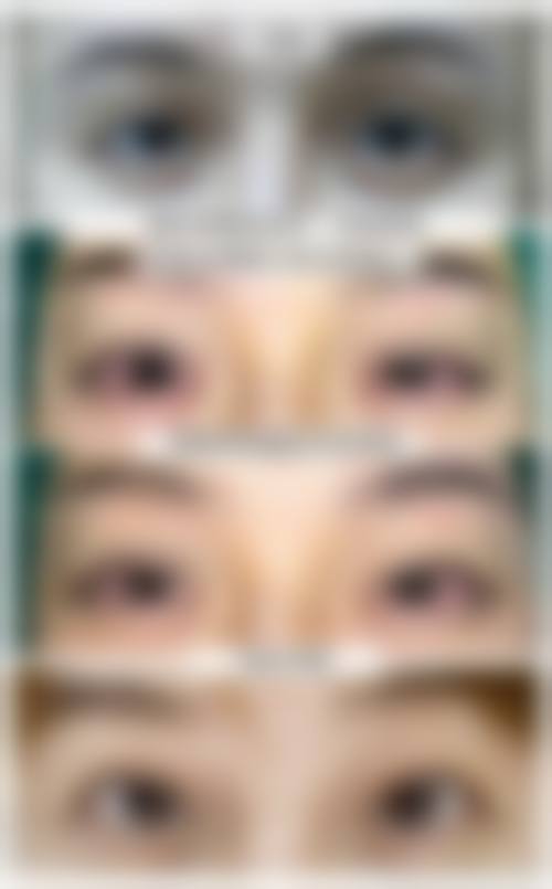 五、安庆增美医疗美容门诊实例