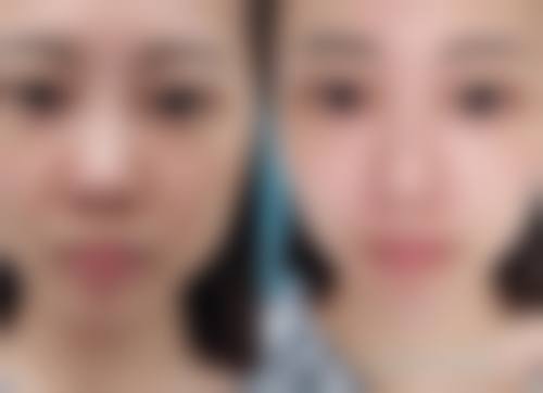 七、贵阳白云东美整形医院真实的顾客评价如下：