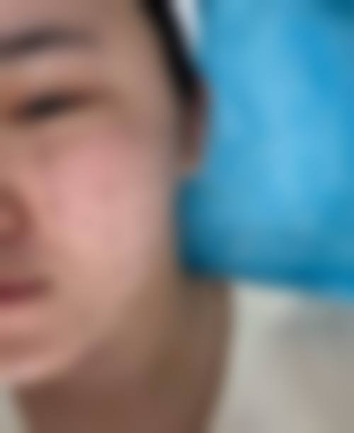 七、韩国弗洛雷斯flores皮肤科真实的顾客评价如下：