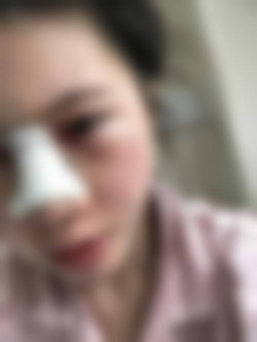 四、贵阳白云东美整形医院实例