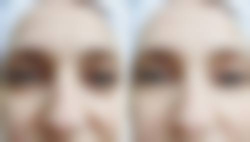 六、岳阳禾美荟医疗美容怎么预约：