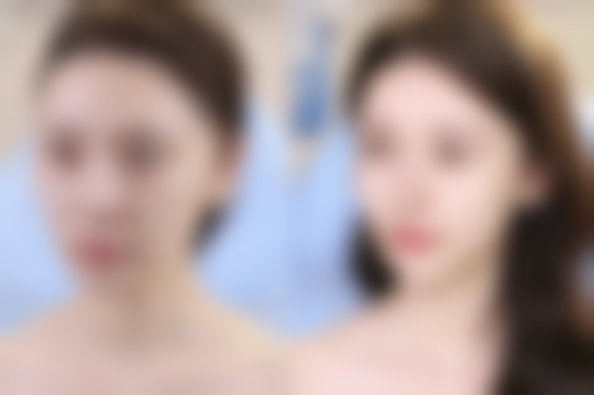 六、安庆增美医疗美容门诊怎么预约：