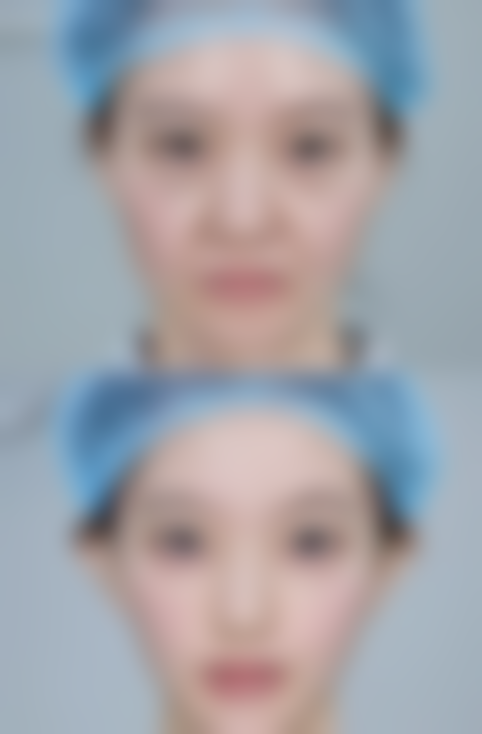 四、韩国弗洛雷斯flores皮肤科实例