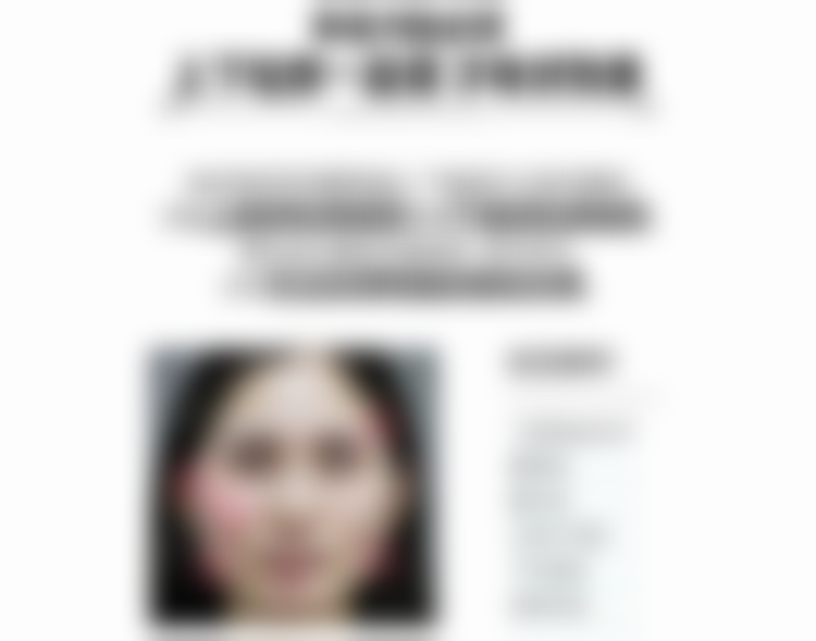 北京圣嘉新医疗美容医院宋超超医生全肋软骨隆鼻19800元起，术后效果自然顾客满意度高 