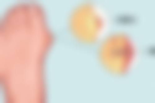 眼袋手术安心吗？风险可控，无需担忧