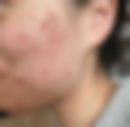 卢植生医生怎么样可靠吗？