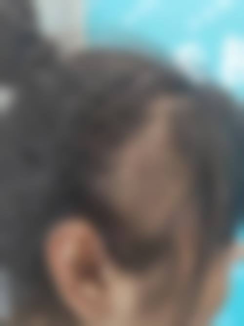 六、南昌科发源植发整形怎么预约：