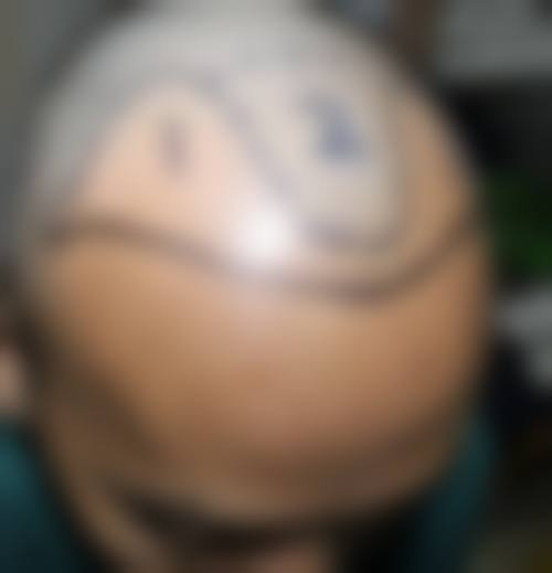 三、南昌科发源植发整形医生介绍: