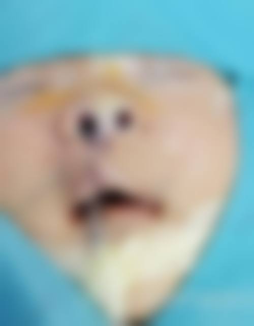 吕英医生在哪家医院怎么预约？