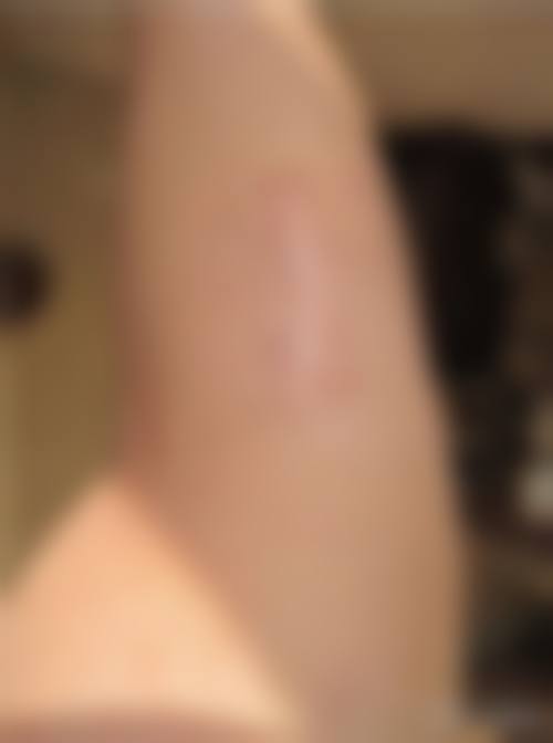 卢植生医生口碑和评价