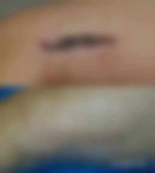 卢植生医生实例