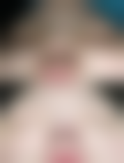 八、北京禾力康美容整形医院真实的顾客评价如下：