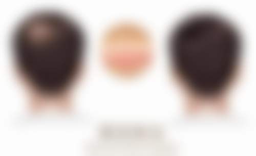 张严严医生怎么样可靠吗？