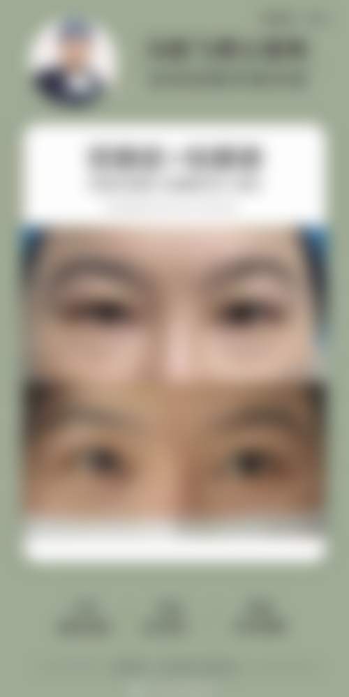 张严严医生项目价格表参考